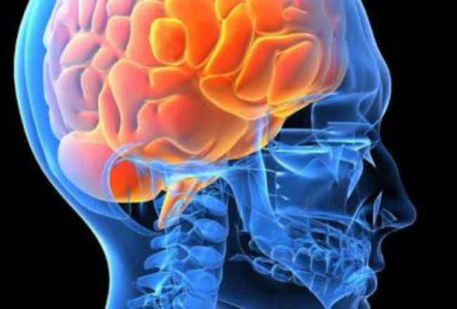 Enfermedad Vascular Cerebral