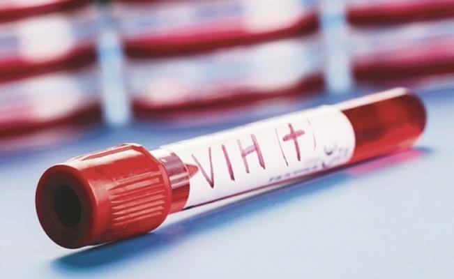 VIH, SIDA y personas con Discapacidad.