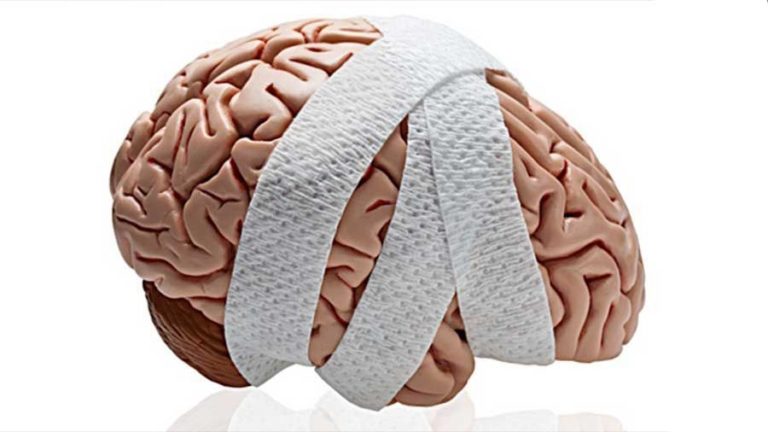 No tengas miedo de la movilización temprana en la lesión cerebral aguda