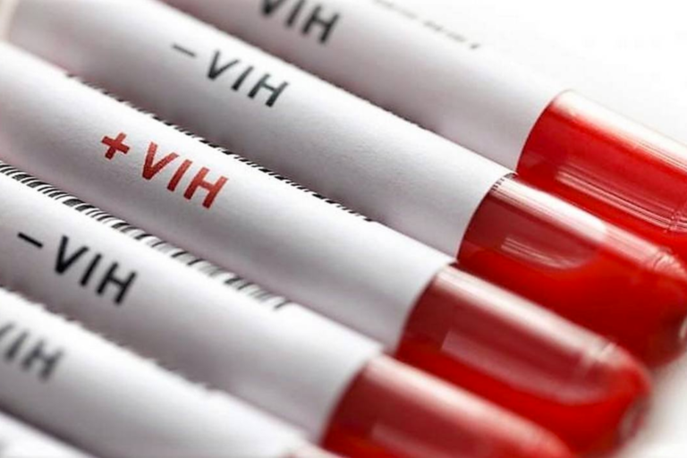 vih