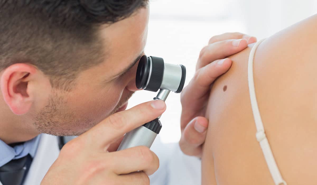 Melanoma