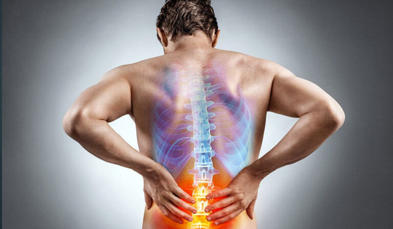 espondilitis