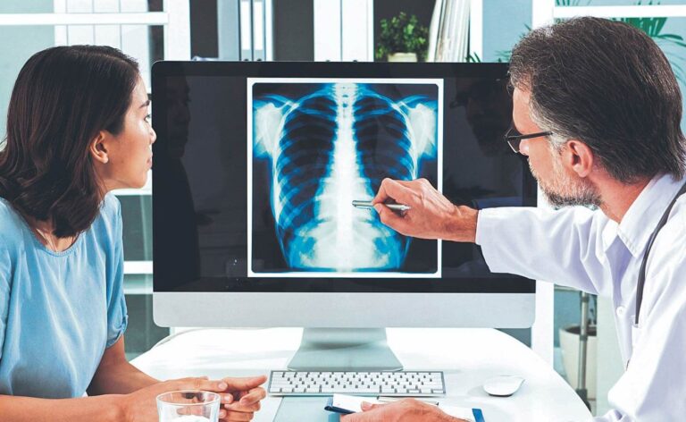 Cáncer de pulmón en México letal, por su detección tardía.